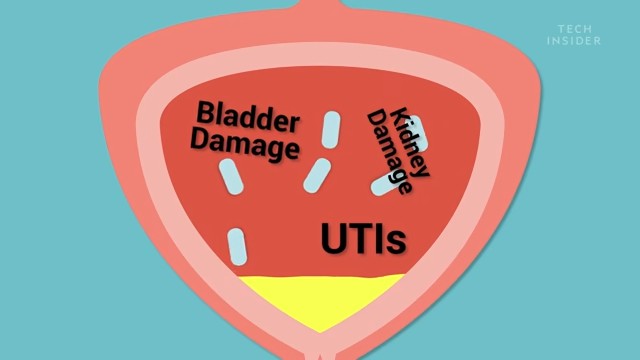 How long can you hold in your pee: Timing and dangers