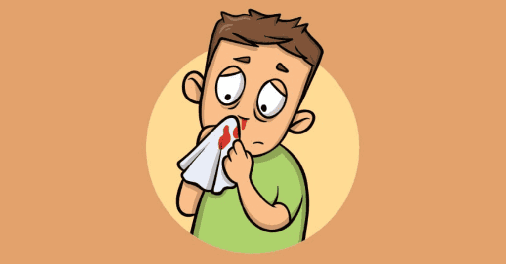 Busting Myths: The Real Reasons Why Your Nosebleed