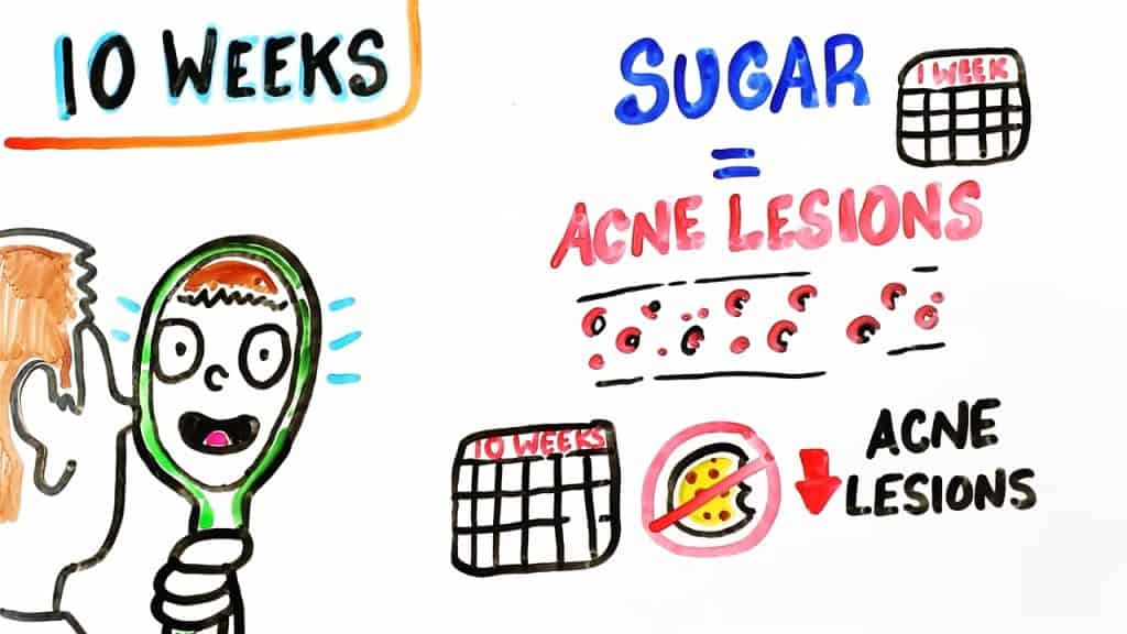 What Happens When You Cut Out Sugar?